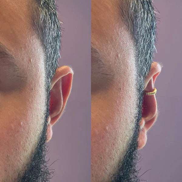 Earfix – Wiederverwendbarer Ohrring für einen natürlichen Look der dein Gesicht harmonisiert